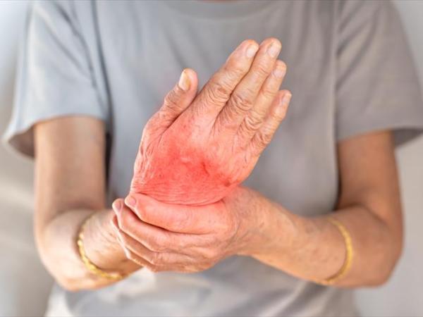 Myths and Facts about Rheumatoid&nbsp;Arthritis